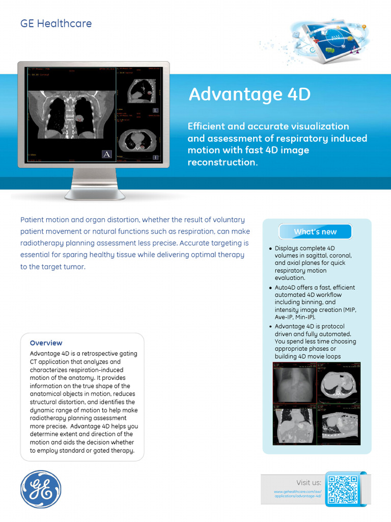 4D Respiratory Motion Assessment Tool | PDF | Ct Scan | Radiation Therapy