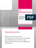 Expo Sic Ion de Hipopotasemia e a