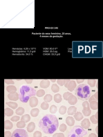PRO-EX 245 Paciente Do Sexo Feminino, 20 Anos, 4 Meses de Gestação