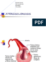 Ate Roe Sclerosis