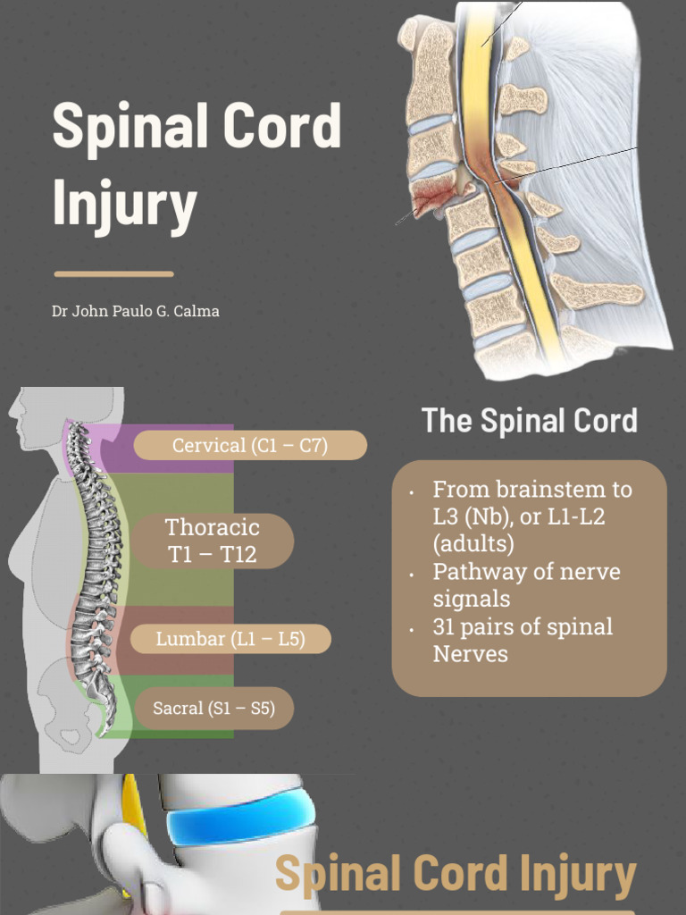 Complete vs Incomplete Spinal Injury | PDF
