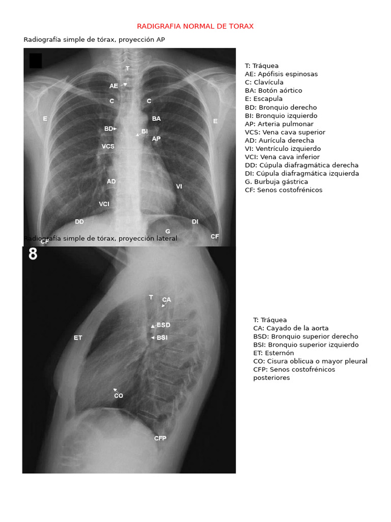 Radiografía Normal de Tórax | PDF | Extremidades (anatomía) | Sistema ...