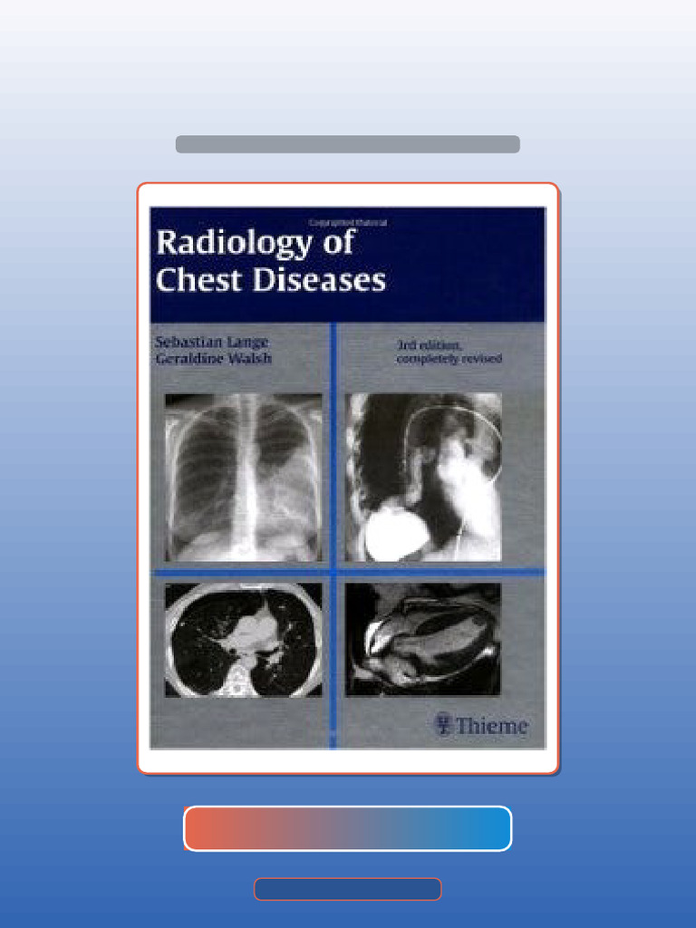 Authorized Radiology of Chest Diseases Ebook and TestBank Bundle | PDF ...
