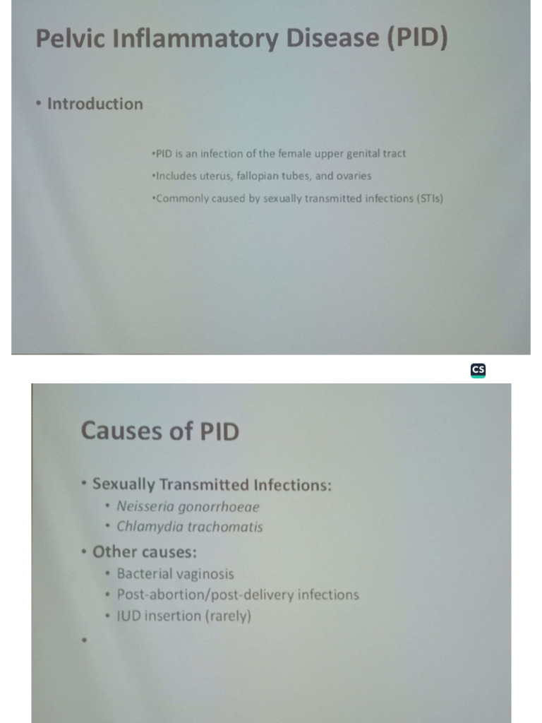 Gynaecology PID | PDF