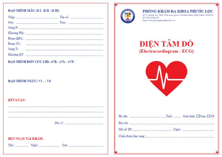File ECG | PDF