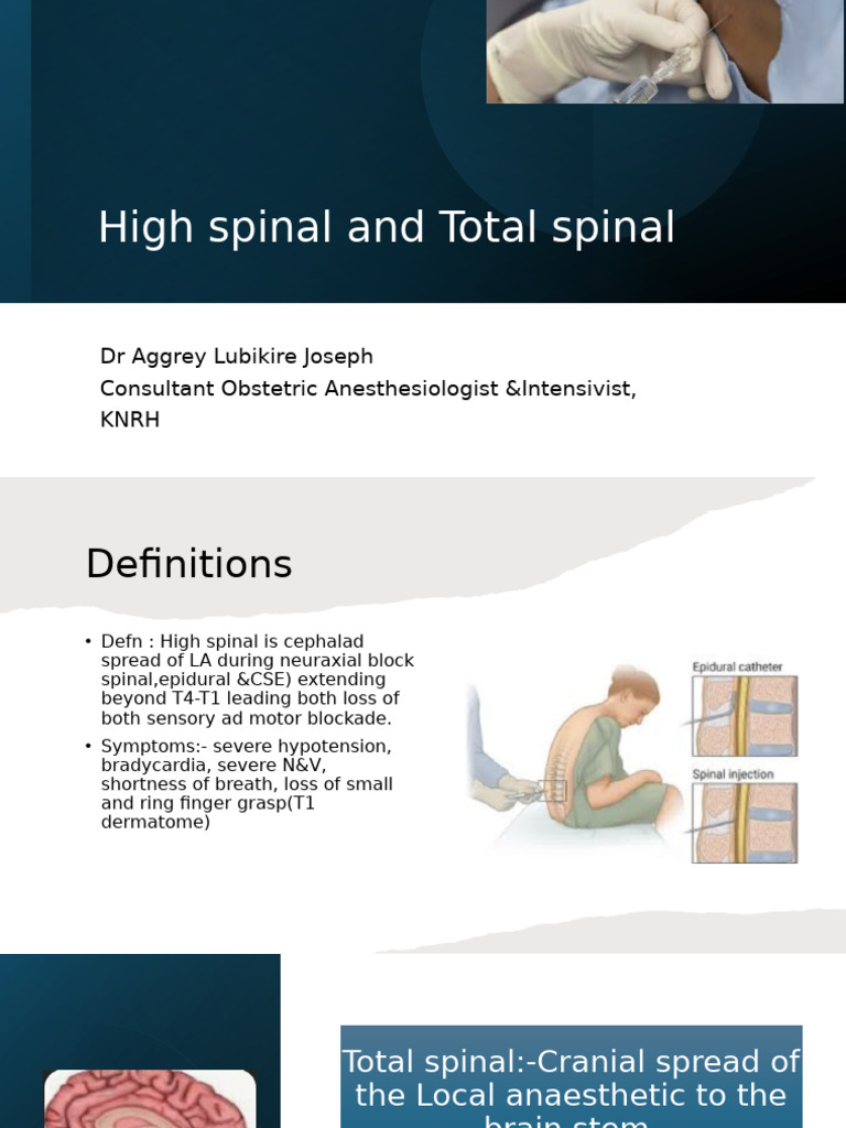 High and Total Spinal Anesthesia Risks | PDF | Anesthesia | Clinical ...
