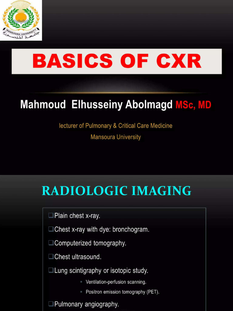 Basics of CXR | PDF