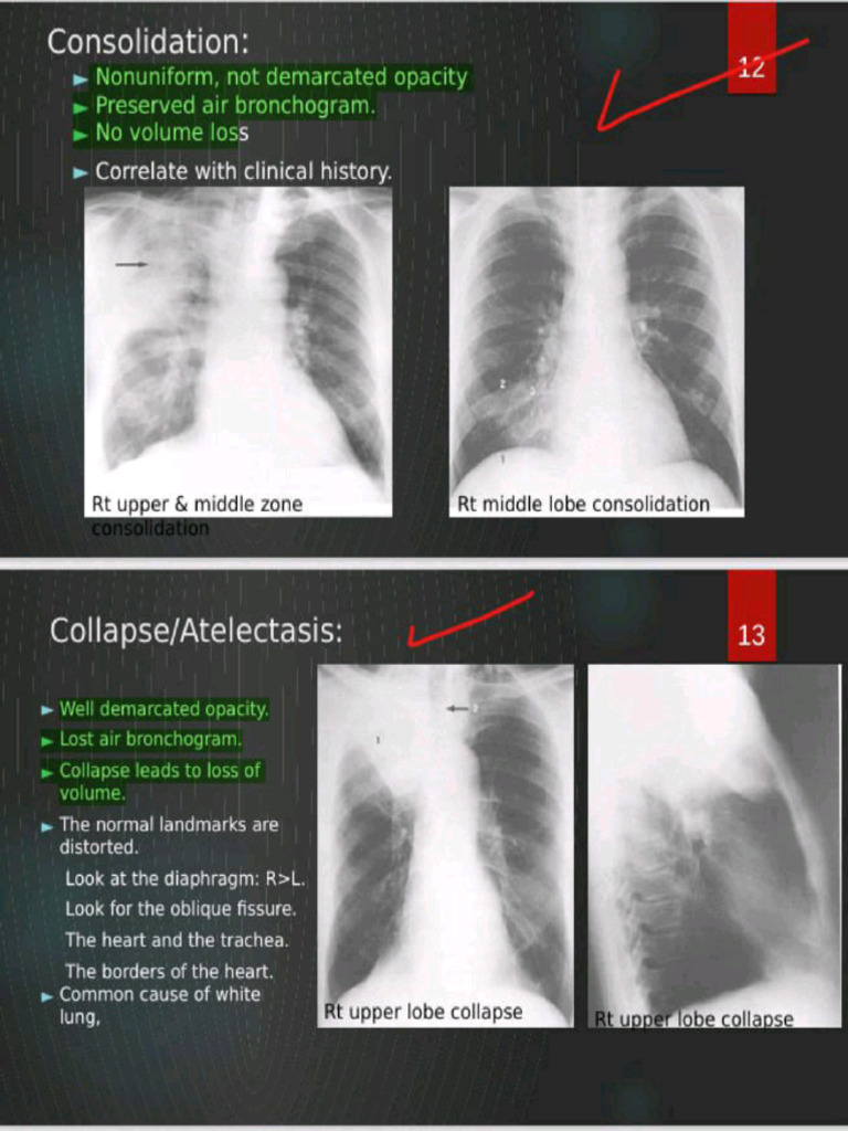 Radiology Extra Practical | PDF
