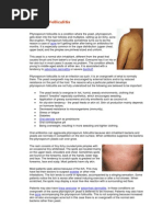 Download Pityrosporum Folliculitis by Andy Sugiharto Wonodiharjo SN93138291 doc pdf