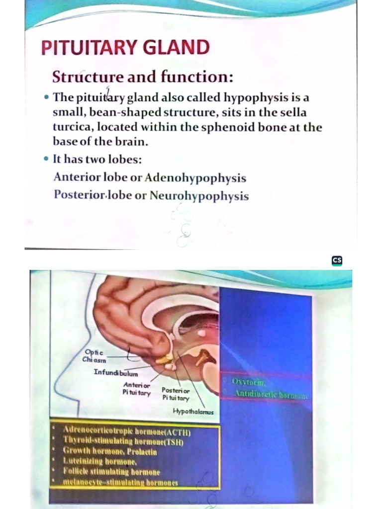 Pituitary Gland Pathology | PDF