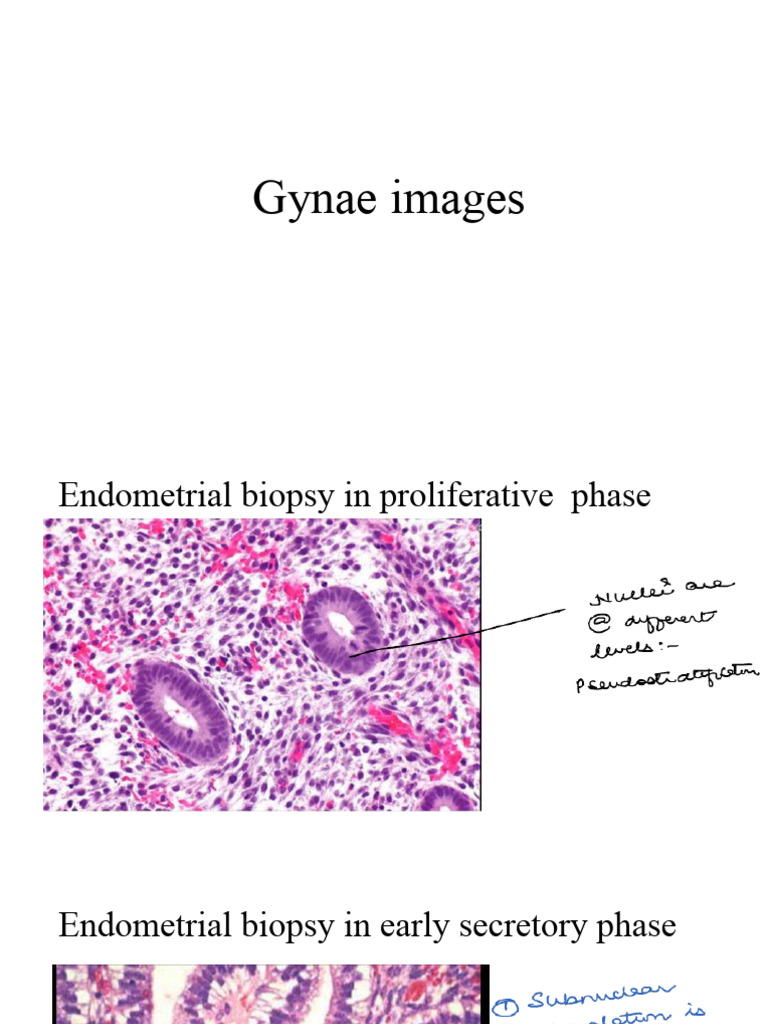 Gynae Imaging and Biopsy Techniques | PDF | Animal Female Reproductive ...