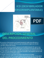 Icd (Desfibrilador Cardioversorimplantable)