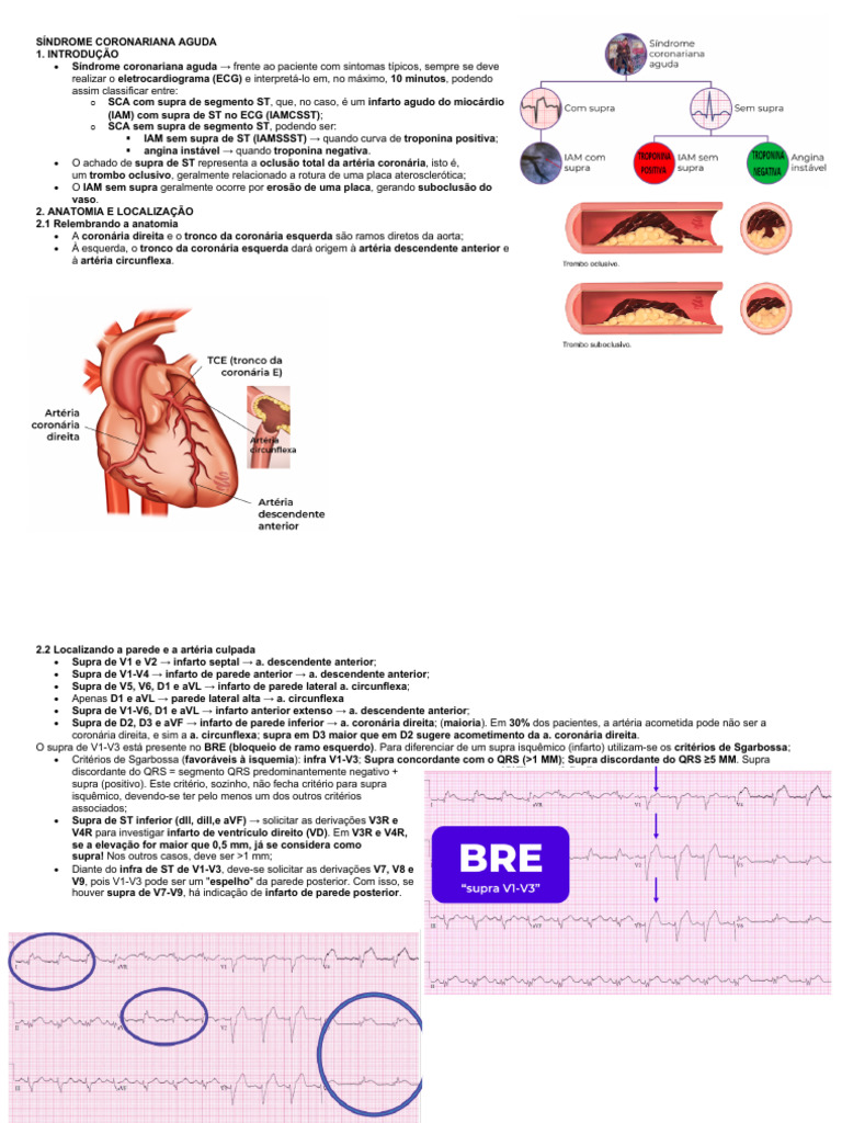 Abordagem da Síndrome Coronariana Aguda | PDF | Infarto do Miocárdio ...