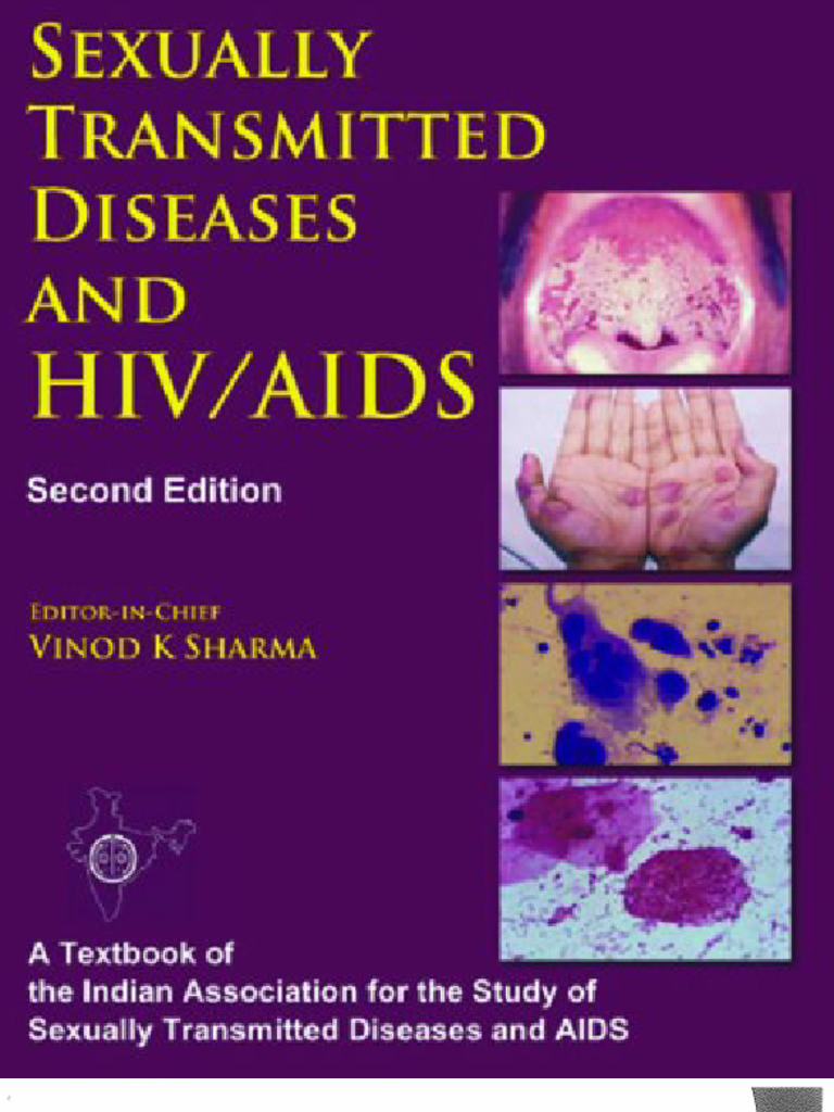 Vinod K. Sharma - Sexually Transmitted Diseases and HIV - AIDS-Viva ...