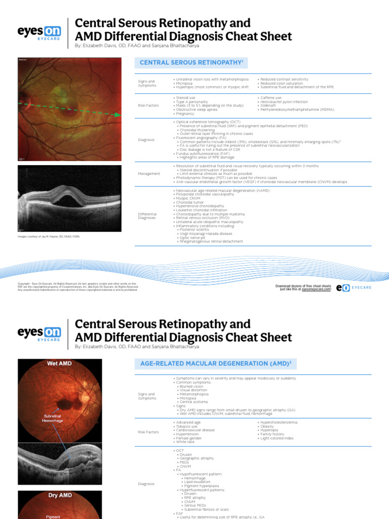 Central Serous Retinopathy Cheat Sheet | PDF | Ophthalmology | Medical ...