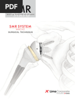 Lima - SMR TT Augmented 360 Metal Back - en | PDF | Shoulder ...