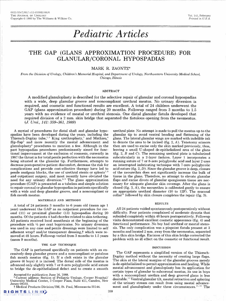 Zaontz The Gap (Glans Approximation Procedure) For Glanular Coronal ...
