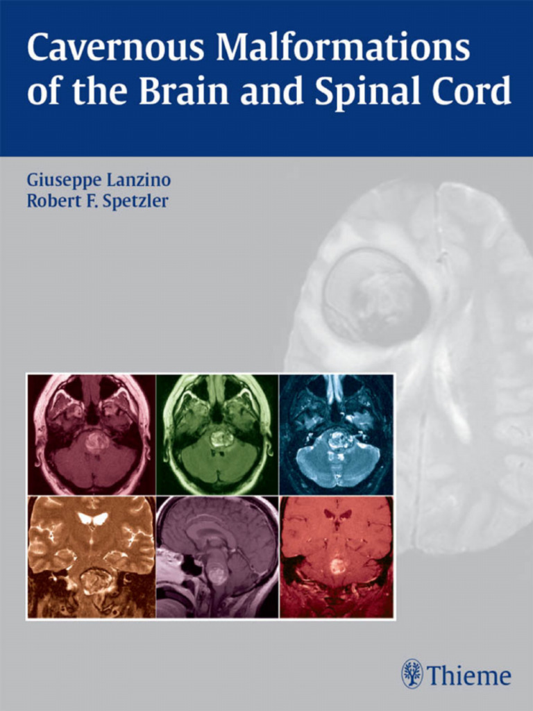 Cavernous Malformations of The Brain and Spinal Cord | PDF ...
