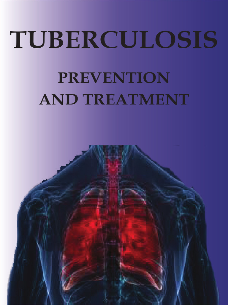 Tuberculosis: Prevention and Treatment Guide | PDF | Tuberculosis ...