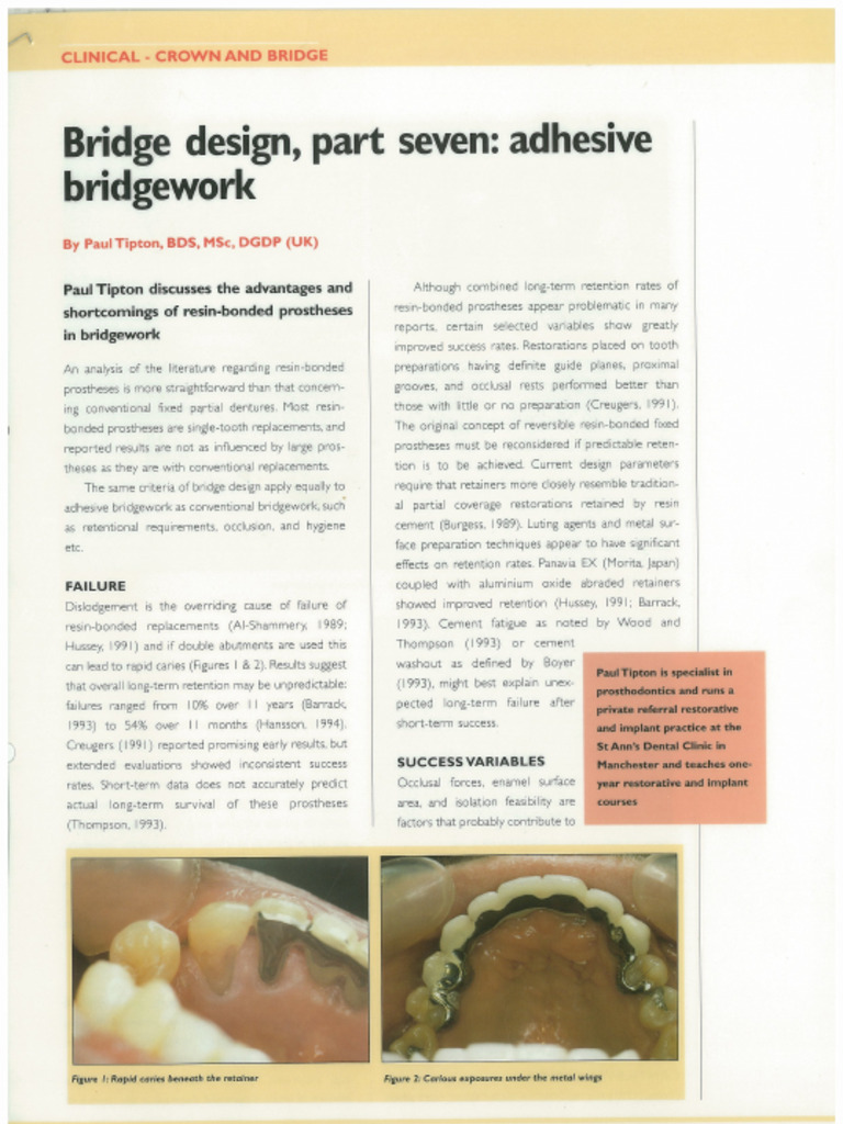 Bridge Design Part 7 | PDF