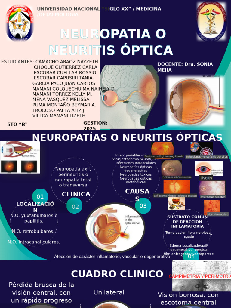 Neuritis Optica 111 | PDF | Isquemia | Enfermedades y trastornos