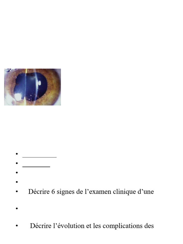 Comprendre les Uvéites : Définitions et Classifications | PDF ...