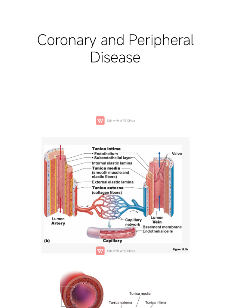 Understanding Ischemic Heart Disease | PDF | Myocardial Infarction ...