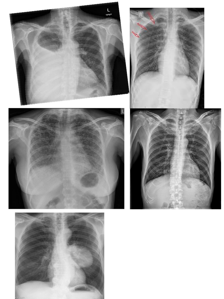 RX Fotos Trabajo | PDF