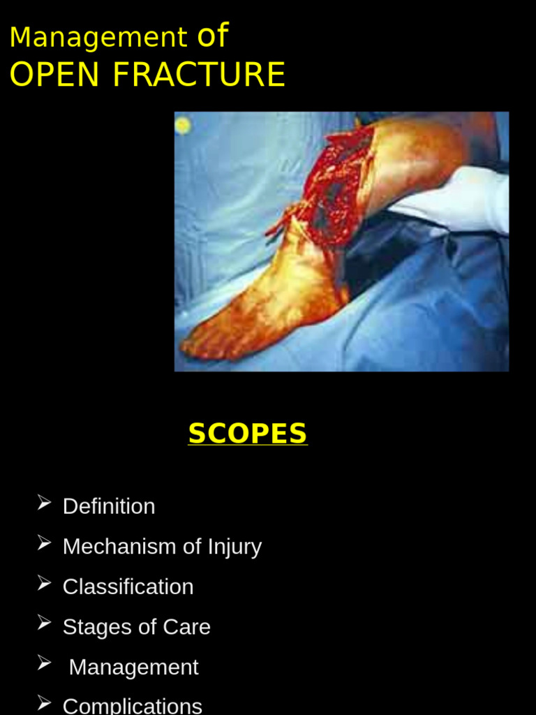 Open Fracture Management | PDF | Wound | Musculoskeletal Disorders