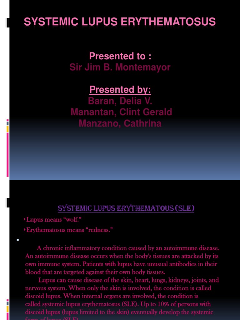 Understanding Systemic Lupus Erythematosus | PDF | Systemic Lupus ...