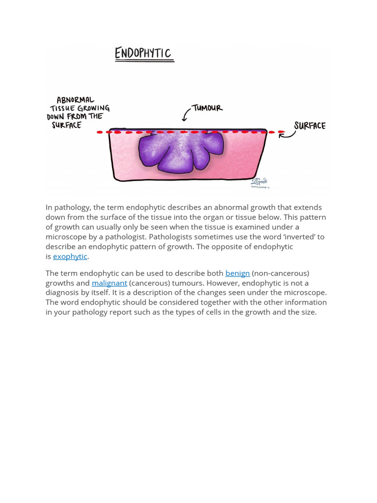Endophytic vs Exophytic Tumors Explained | PDF