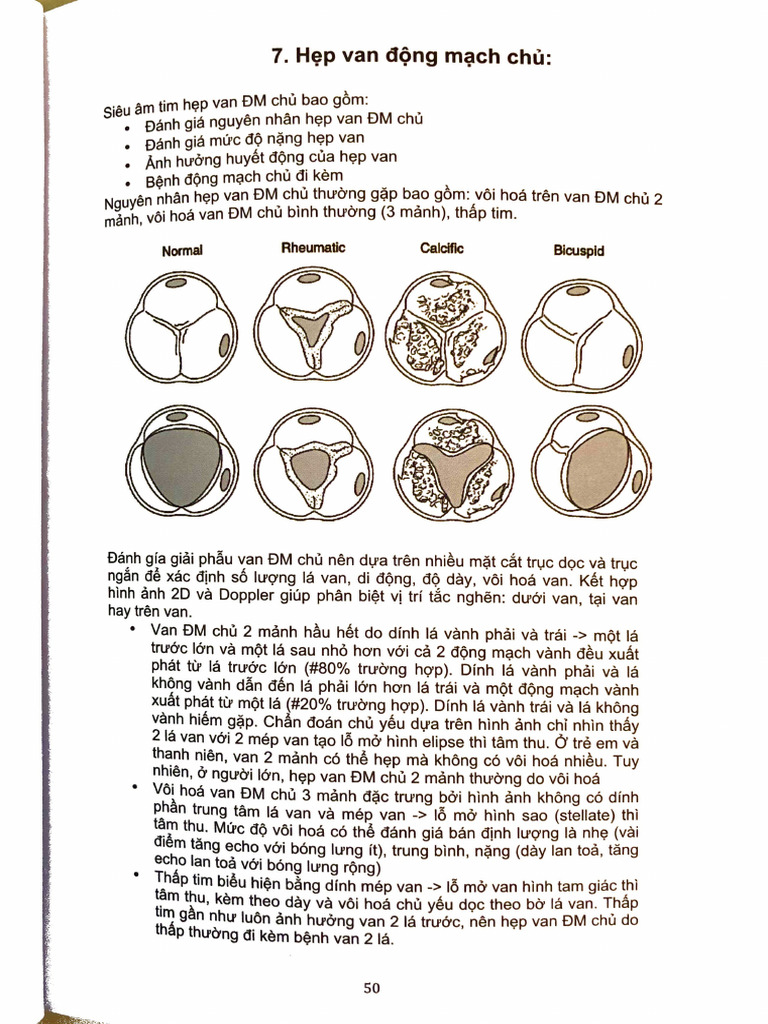 Satcr- Hẹp Van Động Mạch Chủ | PDF
