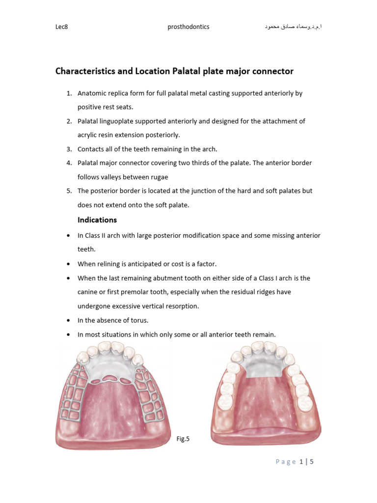 Maxillary Major Connectors Overview | PDF | Tooth | Mouth