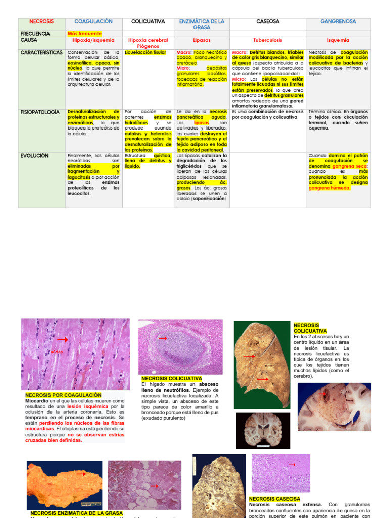 Necrosis | PDF | Inflamación | Necrosis