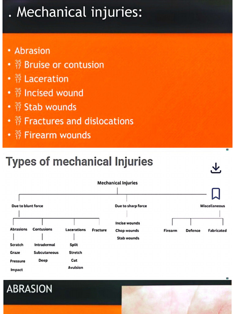 Mechanical Injuries by AHM. | PDF