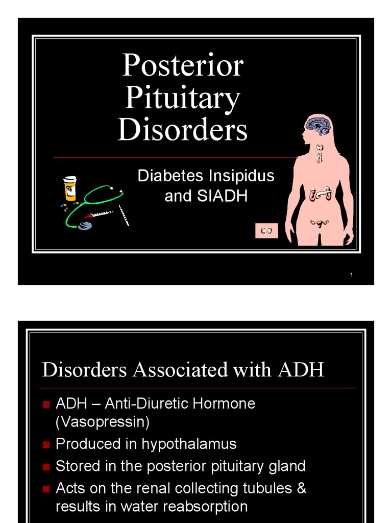Di and Siadh PDF Kidney Dehydration