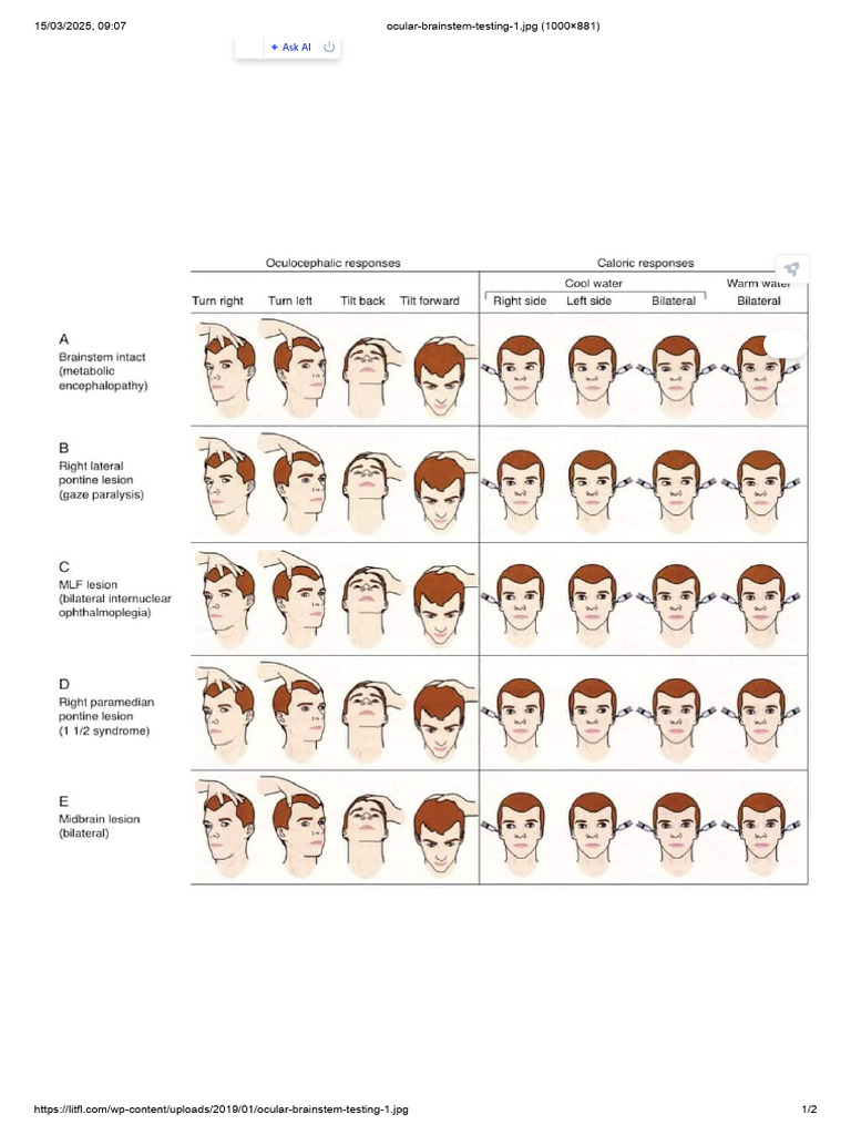 Ocular Brainstem Testing Image | PDF