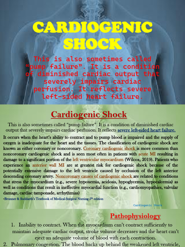 Understanding Cardiogenic Shock Symptoms | PDF | Heart | Shock ...