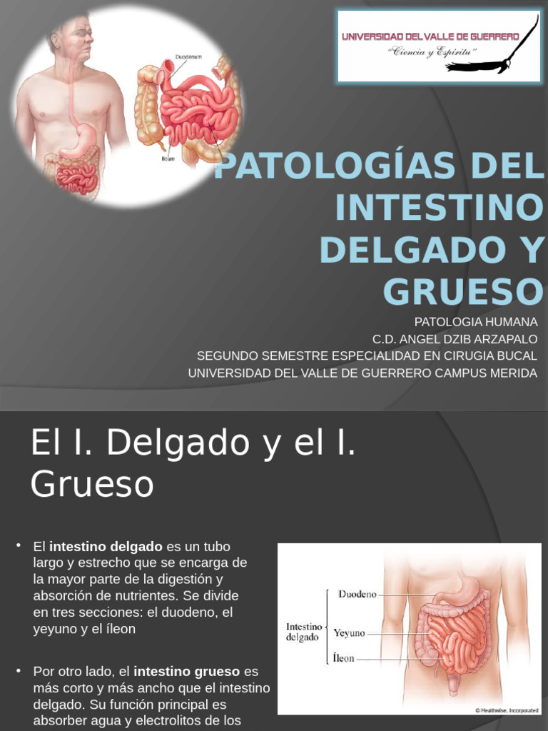 Patologías del Intestino Delgado y Grueso | PDF | Tracto ...