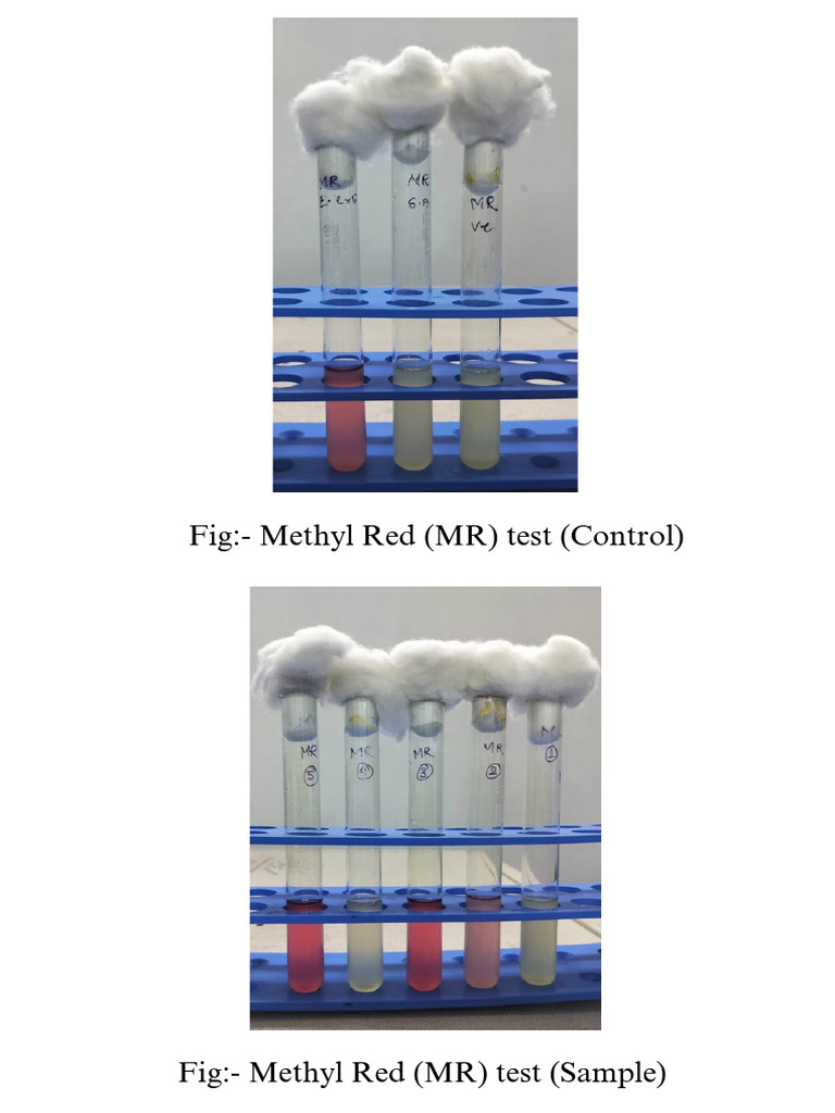 MR Test PDF | PDF