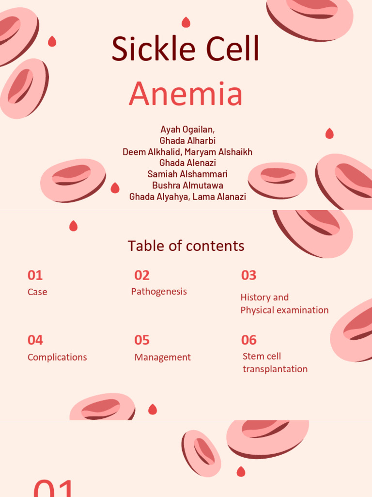 Case Discussion Sickle Cell Anemia 2 | PDF | Anemia | Hematopoietic ...