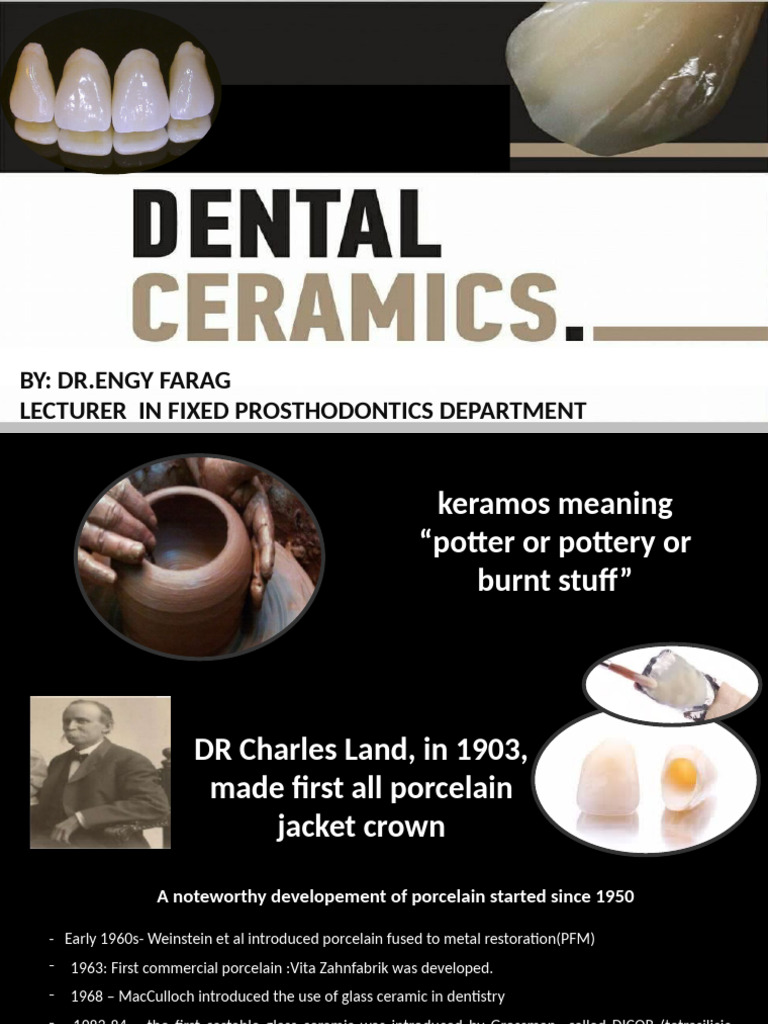 Evolution of Dental Ceramics and Porcelain | PDF | Fracture | Ceramics