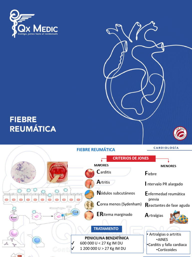 Fiebre Reumática: Criterios y Tratamiento | PDF