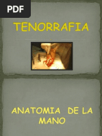 Download Tenorrafia Final by Lilita Acosta SN93554557 doc pdf