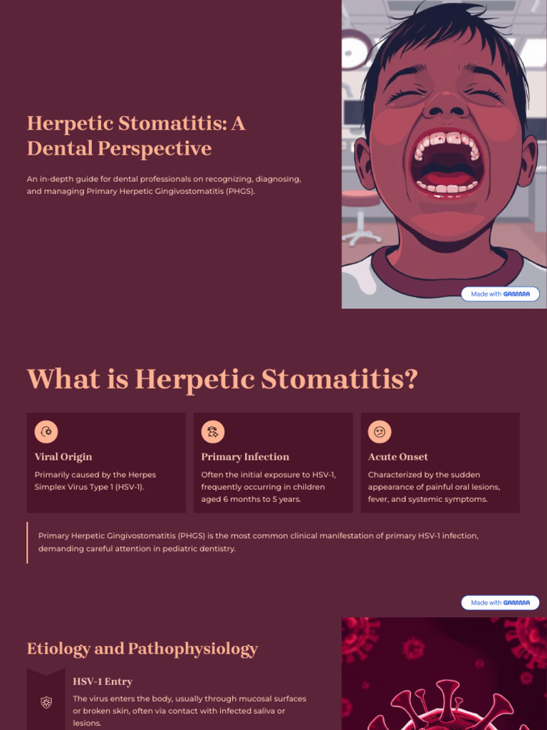 Herpetic Stomatitis: Dental Management Guide | PDF | Health Sciences ...