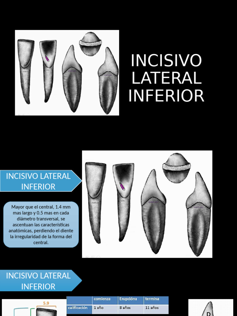 Anatomía del Incisivo Lateral Inferior | PDF