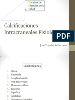 Calcificaciones Intracraneales Fisiológicas