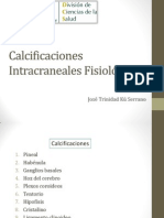3.- Calcificaciones Intracraneales Fisiológicas