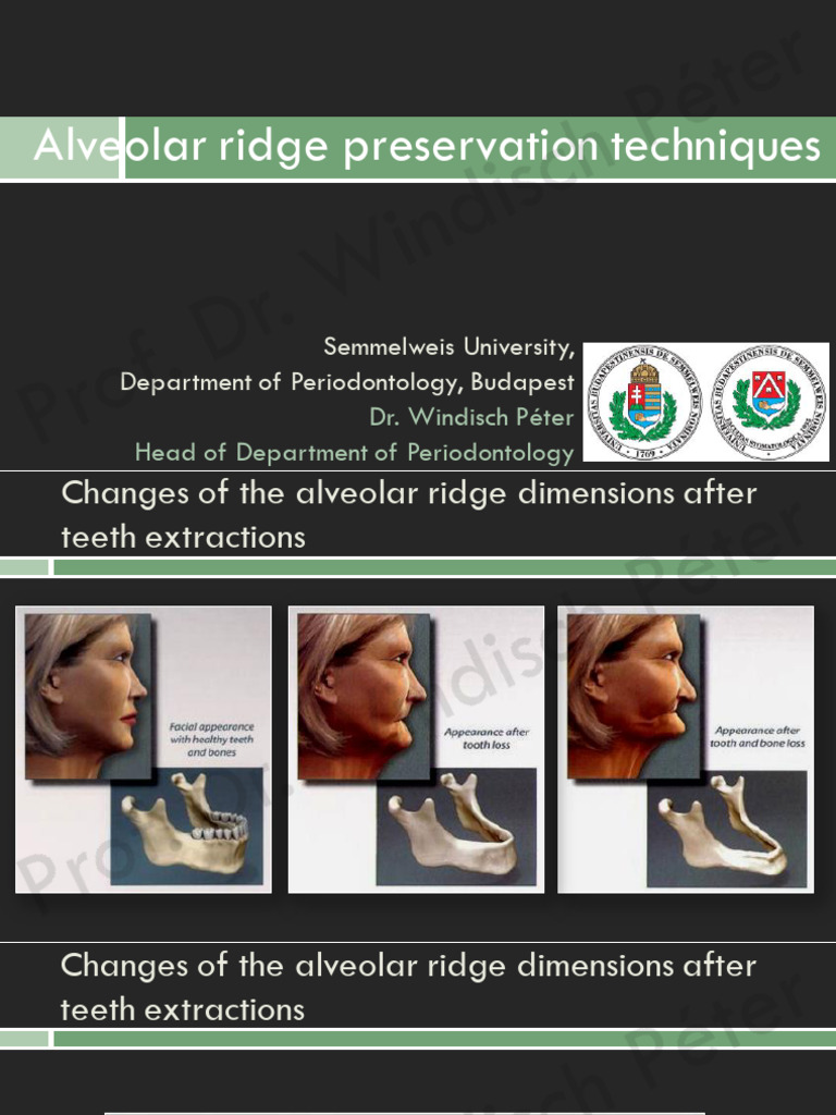 Alveolar Ridge Preservation Techniques | PDF | Dental Implant ...
