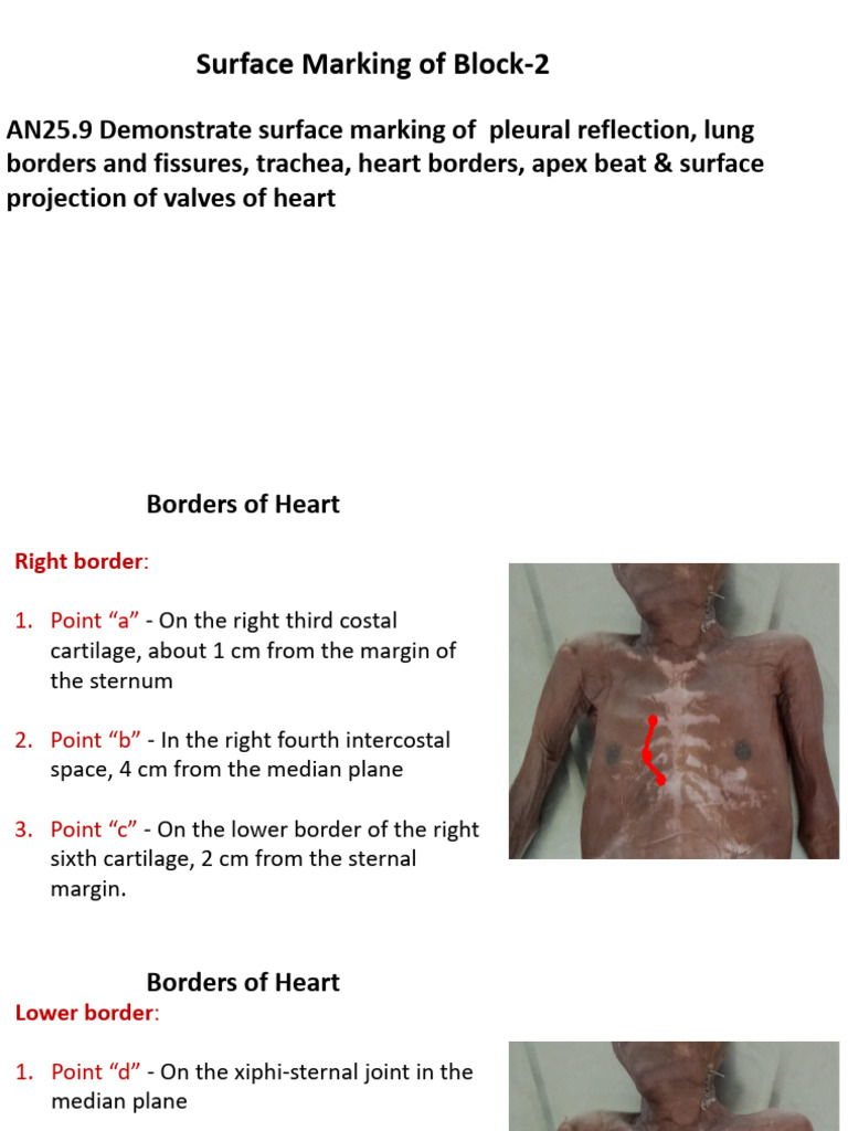 Surface Marking | PDF | Common Carotid Artery | Anatomical Terms Of ...